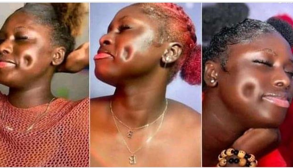 “Is this dimples or Pothole?” —Young Lady goes Viral after sharing the photos of her Unique face on tiktok. (Video)
